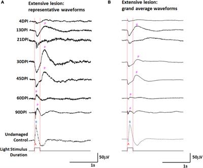 Dynamic functional and structural remodeling during retinal regeneration in zebrafish